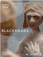 Blackheads